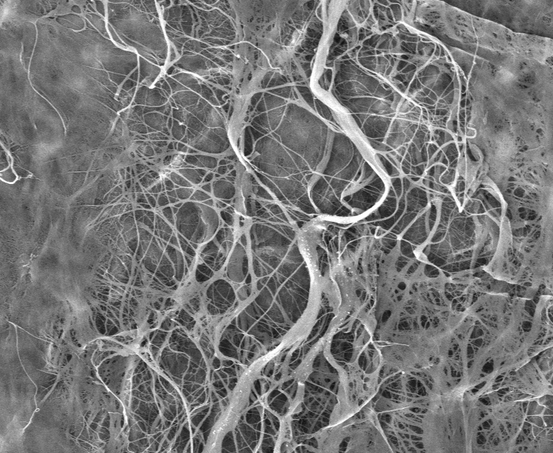 Мембрана стоматологическая bioPLATE CONTUR 15х20